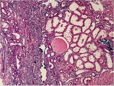 “芯片上的肾小球”功能可媲美真正肾脏